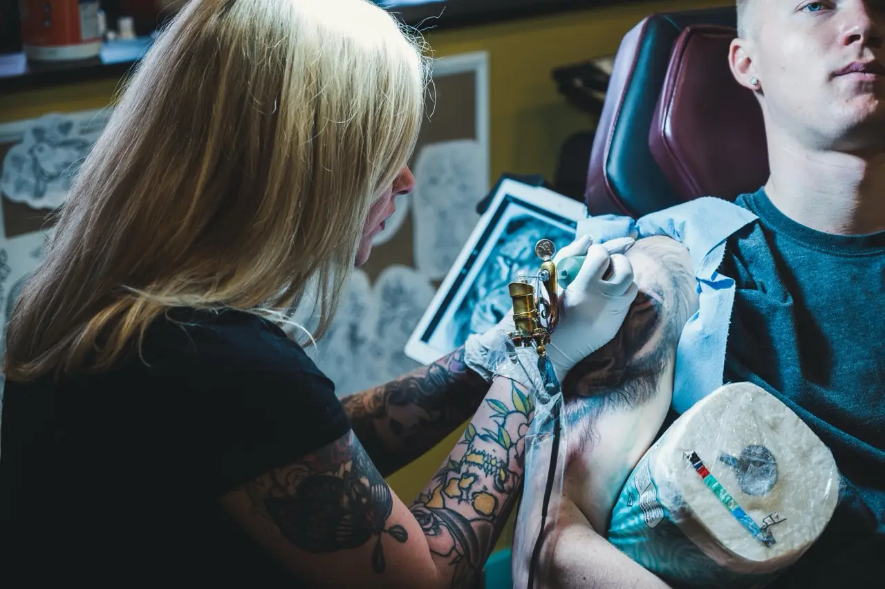 Medische klacht: letsel als gevolg van het verwijderen van een tatoeage